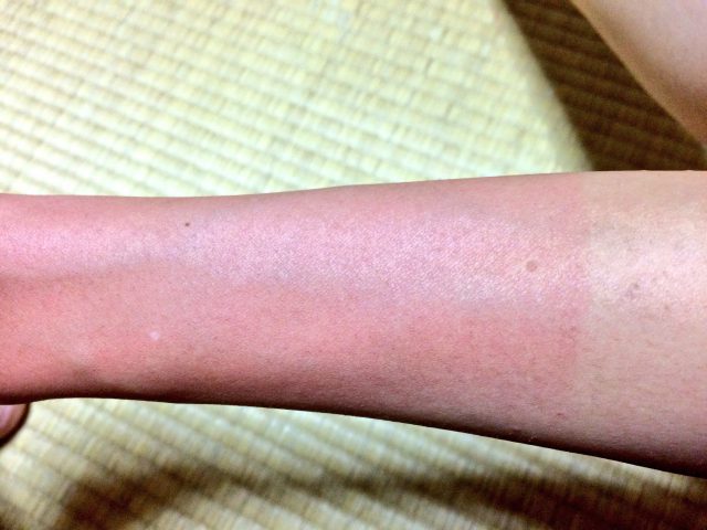 沖縄の海で日焼けした後の肌ケアには アロエジェル を愛用してます 沖縄子育てママブログ